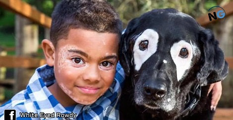 Boy With Rare Disorder Hates His Looks, Then He Meets His Dog Twin!